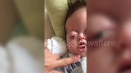 Severely disabled baby girl called a 'monster' by online trolls