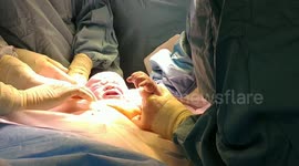 natural caesarean procedure allows baby to 'deliver itself'