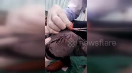 Piegon being treated by doctors as it fell victim of Kite flyers in india.
