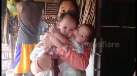 Filipino mother pleads for help to separate her four-month-old conjoined twin daughters
