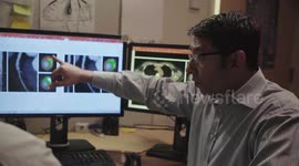 Anti-inflammatory biologic drugs prevent heart disease in psoriasis sufferers