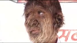 13-year-old 'wolf boy' becomes popular local celebrity in India