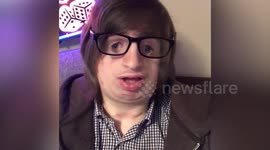 Teenager with a rare genetic disorder which causes facial deformity is