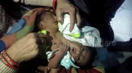 Baby born with two heads and four hands becomes talk of the town in northern India