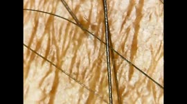 microscopic view of human skin, hair and hair root
