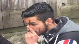 That sucks! Town in north India holds 'leech therapy' on Persian New Year