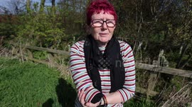 A woman describes horrific story after her hand was bitten off by rescue dog