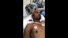 ++GRAPHIC++ Miracle escape for Indian man with iron rod through his head