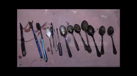 Shocking-Spoons, knife, toothbrush, screwdriver recovered from man’s stomach in Sundernagar