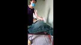 The woman used fire to burn off excess fat and lose weight