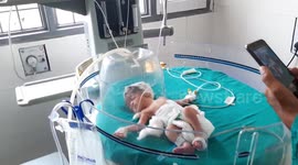 Newborn baby girl in India rescued from drain, where she was found by street dogs
