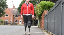 Diabetic UK man has both legs amputated so he can walk down the aisle at his wedding