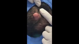 Doctor in Vietnam removes strange tumor from man's head
