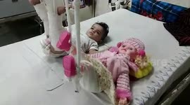Indian doctors plaster 11-month-old's doll to convince her for treatment