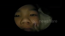 Live leech pulled from the nose of six-year-old boy in Vietnam