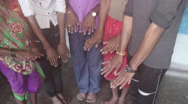 Family in India has bizarre trait where many have 12 finger or 14 toes