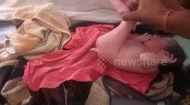 Heavy Crowd gathered in hospital to see new born child with tail in Northern India.