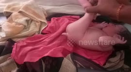 Baby born with a 'second penis' baffles doctors and curious onlookers in India