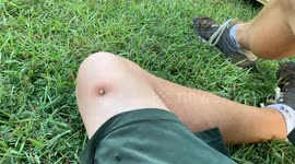 US man shoots 3-inch nail into his thigh and films his journey to hospital