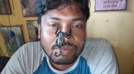 'Scorpion man' is friend to deadly arachnids in east India