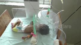 Man rescues infant baby girl buried alive in graveyard in north India