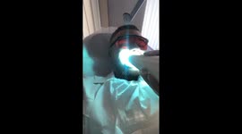 Teeth whitening