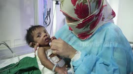 Weeks-old boy fights for his life as rare infection eats nearly half the skin off his back