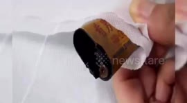 Chinese doctor removes lighter that 'could have exploded at any time' from man's stomach