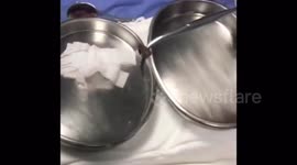 Chinese doctor removes live leech from man's nose