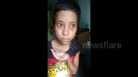 Rare condition sees Indian child sweat blood from 'eyes, nose and ears'