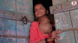 Rare disease leaves 12-year-old girl in India with 'football-sized' tumour on her neck