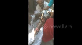 Three-year-old Indian girl with cooking pot stuck on her head gets cut free with scissors