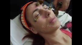 Anti-age facial treatment snails and DermaPen !salon