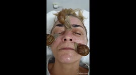Snail mucus ~ Hyperpigmentation  Mon cheri Andjela  Belgrade