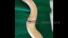 Rat snake injured on barbed wire receives open heart surgery in India