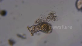 Acuatic microscopic organism swims in a drop of water under the microscope
