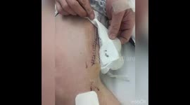 I lost my limb not my life