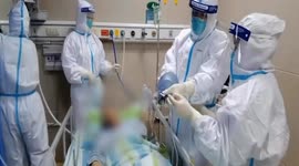 Wuhan hospital successfully treats coronavirus patient with ECMO technique, state media reports