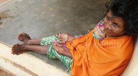 This Indian woman with 19 toes and 12 fingers has faced lifetime of persecution