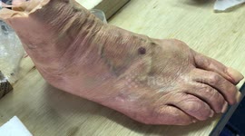 Prosthetic woman foot , does it looks real?