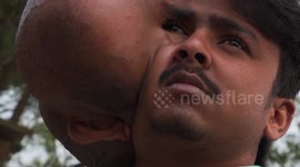 EXCLUSIVE: Man, 21, with football-size tumour on face is treated like an outcast in northern India