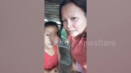 Family of Filipino toddler with facial tumour appeal for medical help