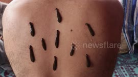 Indian residents celebrate Persian New Year with leech therapy