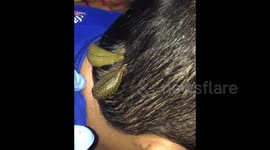 Malaysian leech therapist uses leeches to heal different types of diseases