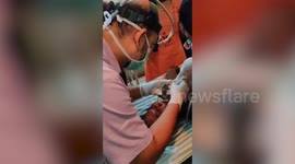 Doctor pulls out whole fish stuck in fisherman's throat in southern India