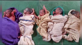 In a unique incident Woman gave birth to five children, all children is healthy