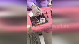 Gruesome moment dentist removes 12 MAGGOTS from pensioner's rotten teeth