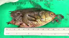 Surgeons remove fish stuck in teenager's throat in Thailand