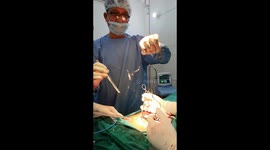 Man has 2ft-long phone charger removed from his bladder in India after inserting it into his penis
