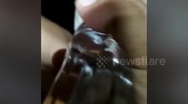 Firefighters remove ring stuck on girl's finger in Indonesia